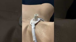 Pulsatile tracheostomy tube simulation, Alberta Health Services.
