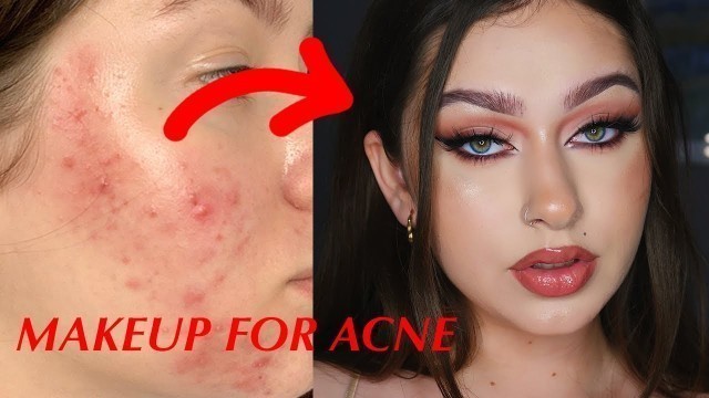 'HOW I COVER MY ACNE + SCARS (FLAWLESS BASE)'
