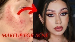 'HOW I COVER MY ACNE + SCARS (FLAWLESS BASE)'