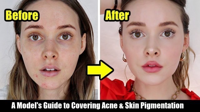 'How I Cover My Acne, Acne Scars, & Skin Pigmentation | A Model\'s Tips *Easy, Non-Cakey*'