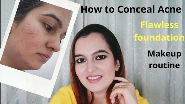 How to cover Acne | Full coverage | Makeup Tutorial