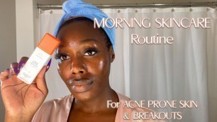 'My MORNING SKINCARE ROUTINE | ACNE PRONE SKIN & BREAKOUTS after FENTY SKIN | The Princess Lifestyle'