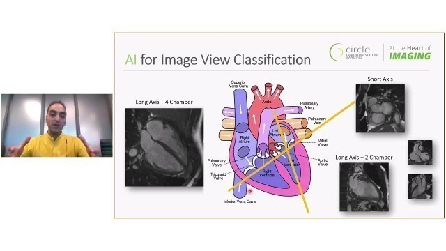 Alberta Health Services (AHS) Artificial Intelligence (AI) CoP - AI in Cardiac Imaging