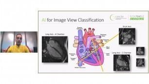 Alberta Health Services (AHS) Artificial Intelligence (AI) CoP - AI in Cardiac Imaging