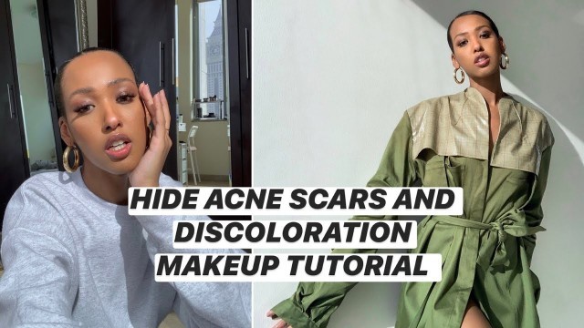 My Flawless Makeup Routine for Acne Scars + Discoloration