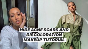 My Flawless Makeup Routine for Acne Scars + Discoloration
