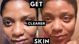 GET CLEARER SKIN! | I TRIED AMBI SKINCARE PRODUCTS FOR 30 DAYS! | KHEL