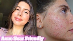 'ACNE SCAR FRIENDLY MAKEUP TUTORIAL | How I cover my acne scars, natural dewy, glowy makeup'