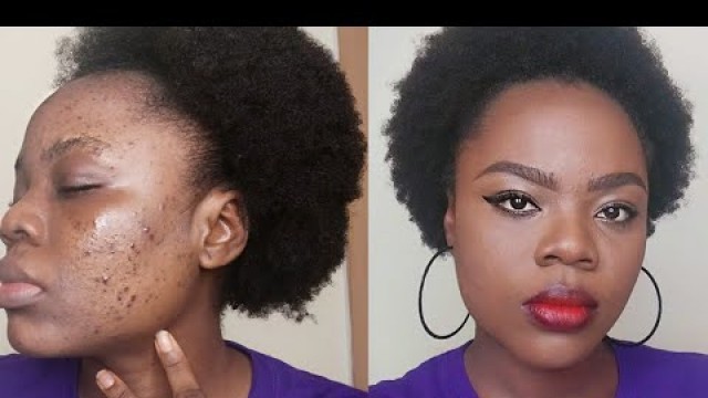 'ACNE FOUNDATION ROUTINE | HOW TO COVER DARK SPOTS | LA FRANCES'
