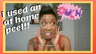 'At Home Facial Peel || m-61 PowerGlow Peel Review || My First Vlogmas'