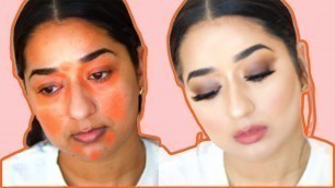 'Full Coverage Foundation Routine Hide Acne Scars Dark Spots'