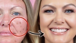 'HOW TO COVER AGE SPOTS, ACNE SCARS, AND HYPER-PIGMENTATION WITH MAKEUP'