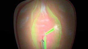 Greenlight Animation Video - Adena Health System