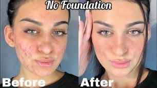 HOW I COVER ACNE WITH NO FOUNDATION | MAKEUP UNDER 4 MINUTES