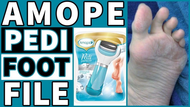 Amope Pedi Perfect Electronic Foot File With Diamond Crystals