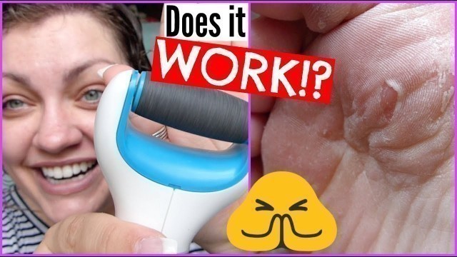 Amope Pedi Perfect Electronic Foot File | Demo, Results, & Review!
