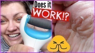 Amope Pedi Perfect Electronic Foot File | Demo, Results, & Review!