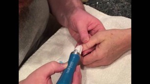 'REVIEW – HealthyWiser Nail Care System'