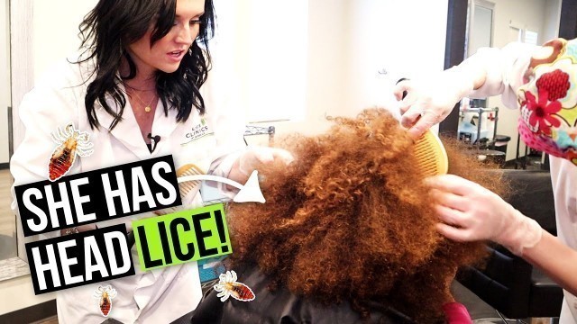 Lice and Nits in African American Hair! How to Remove Lice from a Big Beautiful Afro