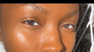 AFFORDABLE SKINCARE ROUTINE FOR ACNE & DARK MARKS | FEATURING BLACK GIRL SUNSCREEN