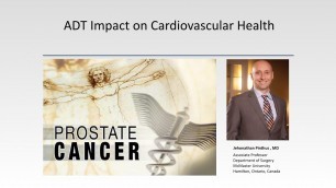 ADT Impact on Cardiovascular Health
