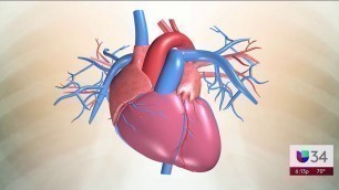 DR SALAZAR SINDROME DEL CORAZON ROTO Noticias Univision 34, July 14, 2020