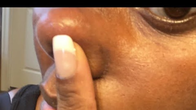 'How to remove dark spots from your face | seamoss| best soap for dark spots'
