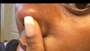 'How to remove dark spots from your face | seamoss| best soap for dark spots'