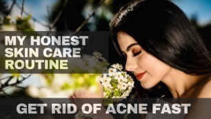 MY HONEST SKIN CARE ROUTINE | HOW I GOT RID OF ACNE | MINIMAL AFFORDABLE PRODUCTS | KIRAT RANDHAWA