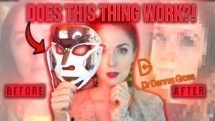 'Dr. Dennis Gross Spectralite Faceware Pro LED Mask HONEST REVIEW After 5 Months!'