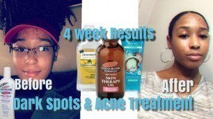Skin Care Routine | Fade Dark Spots fast | Get Unready