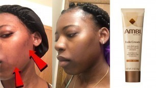 HOW TO FADE ACNE SCARS ft. AMBI Fade Cream