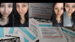 'M-61 Power Glow Peel In Depth Review | NOT SPONSORED | Chemical Peel that Works'