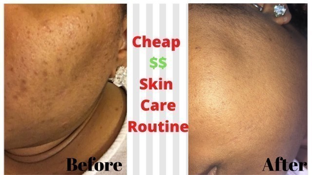 Affordable Skin Care Routine | Fade Dark Spots