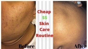 Affordable Skin Care Routine | Fade Dark Spots