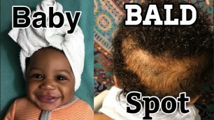 REGROW that Baby BALD-SPOT!!! 3 Products to help you get the job DONE!!