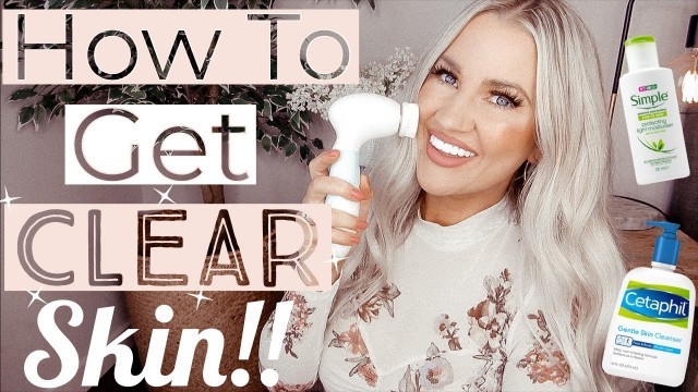 MORNING SKINCARE ROUTINE FOR OILY SKIN GRWM || HOW I GOT RID OF ACNE || DUVOLLE RADIANCE SPIN BRUSH