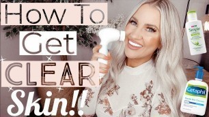 MORNING SKINCARE ROUTINE FOR OILY SKIN GRWM || HOW I GOT RID OF ACNE || DUVOLLE RADIANCE SPIN BRUSH