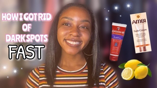 HOW TO GET RID OF DARK SPOTS FAST | Kenzi M.