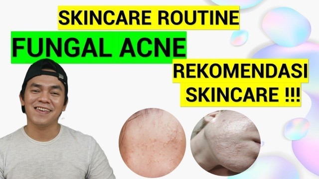 SKINCARE ROUTINE UNTUK FUNGAL ACNE/BERUNTUSAN | REKOMENDASI SKINCARE UNTUK MENGATASI FUNGAL ACNE