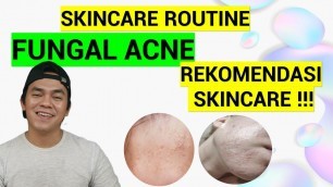 SKINCARE ROUTINE UNTUK FUNGAL ACNE/BERUNTUSAN | REKOMENDASI SKINCARE UNTUK MENGATASI FUNGAL ACNE
