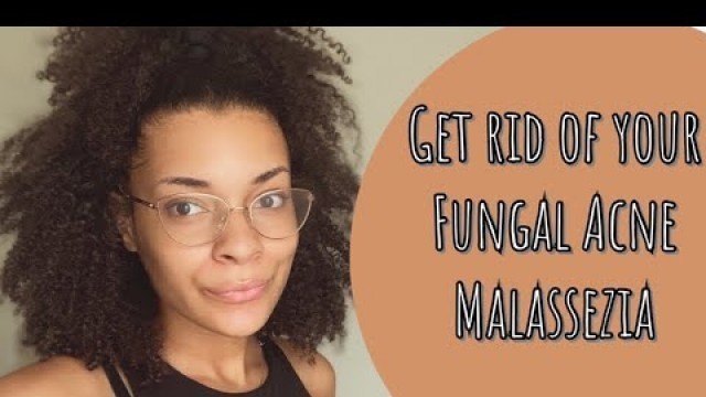 Get Rid of Your Fungal Acne | Glycerin Free Skincare Routine for Fungal Acne | Giveaway Announcement