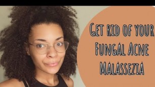 Get Rid of Your Fungal Acne | Glycerin Free Skincare Routine for Fungal Acne | Giveaway Announcement