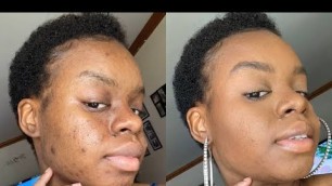 Natural" Beauty Makeup With Drugstore Makeup | Acne Coverage Makeup | Jaleesa Ayoka