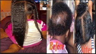 Baby/toddler kids must have hair products for hair growth
