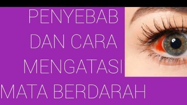 'PENYEBAB DAN CARA MENGATASI MATA BERDARAH krishna healthy beauty channel#SHORTS'