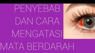 'PENYEBAB DAN CARA MENGATASI MATA BERDARAH krishna healthy beauty channel#SHORTS'