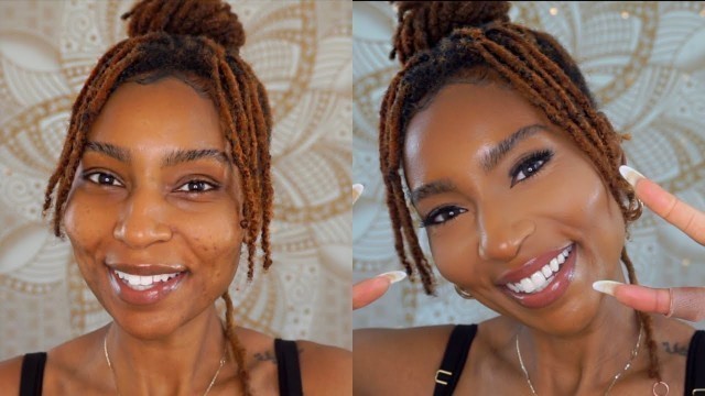 Full Coverage Foundation Tutorial covering dark marks & acne breakout| iamLindaElaine
