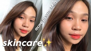 SKINCARE ROUTINE 2020 | KINIS PUTI SKINCARE (ACNE PRONE SKIN)