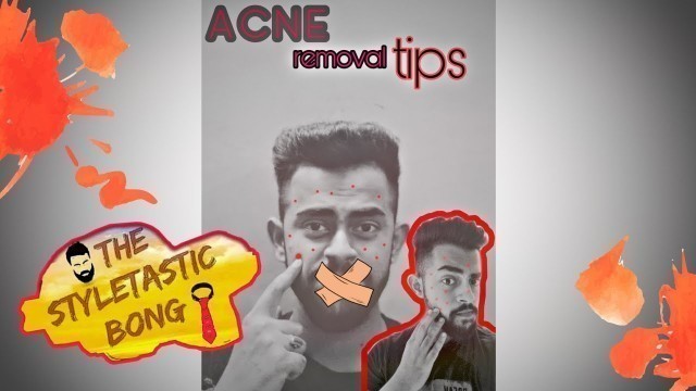 How To Get Rid Of Acne Fast (Mens skin care routine )